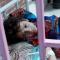 ondervoed kind ligt in bed in een hospitaal in Jemen 